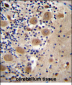 AFG3L2 Antibody (N-term)